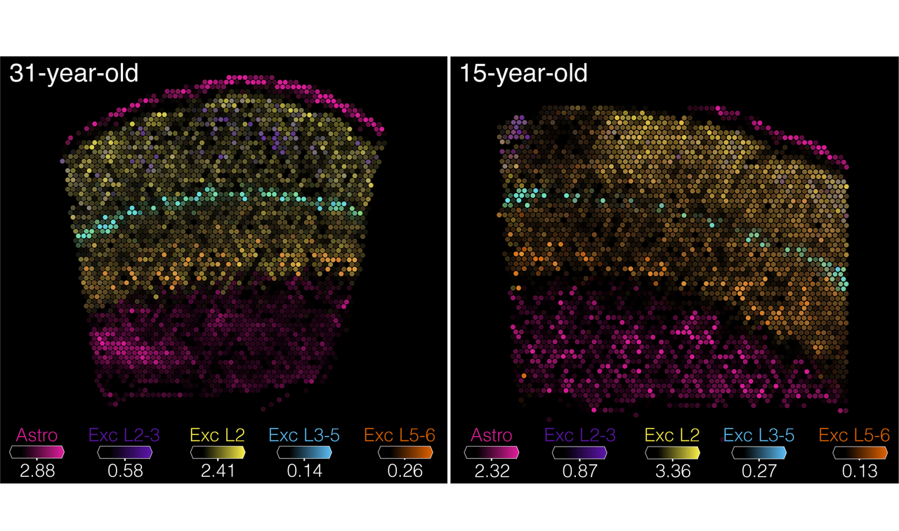 two images showing brain tissue with different types of cells labeled with different colors