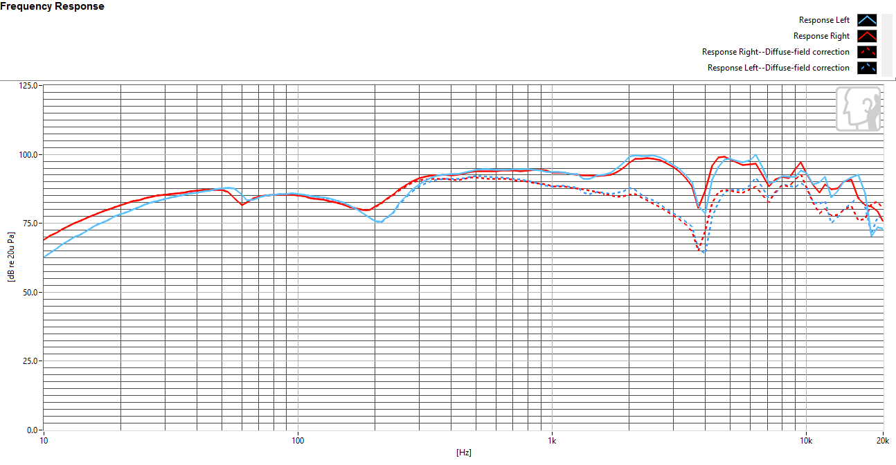 Frequency response