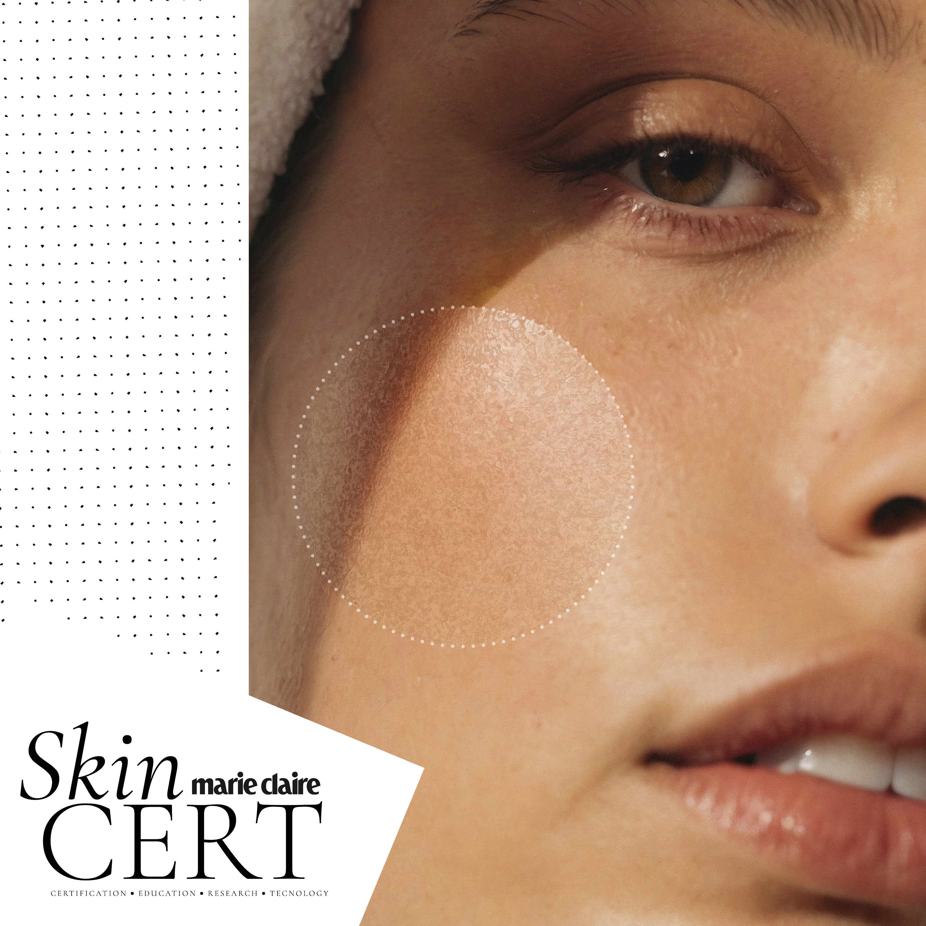 How does alcohol affect the skin