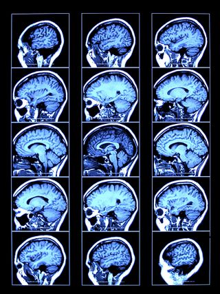 CT scans of a human brain.