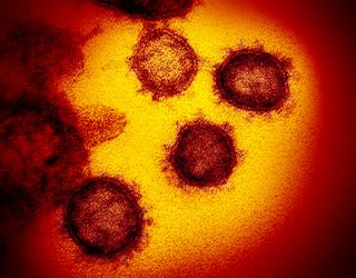 This is a transmission electron microscope image showing the new coronavirus emerging from the surface of human cells.