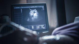 A pregnant woman viewing a sonogram