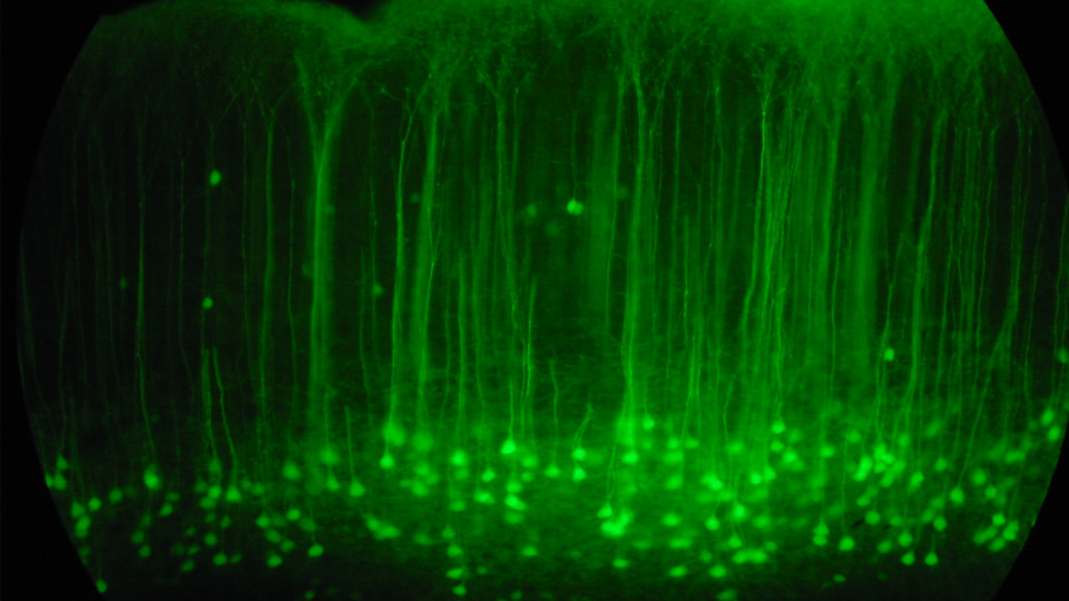 A close look at a slice of mouse brain. Credit: Robert Cudmore