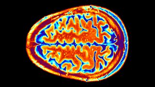 A colorful scan of healthy adult brain as seen from above, with the wrinkles of the cerebral cortex very clear