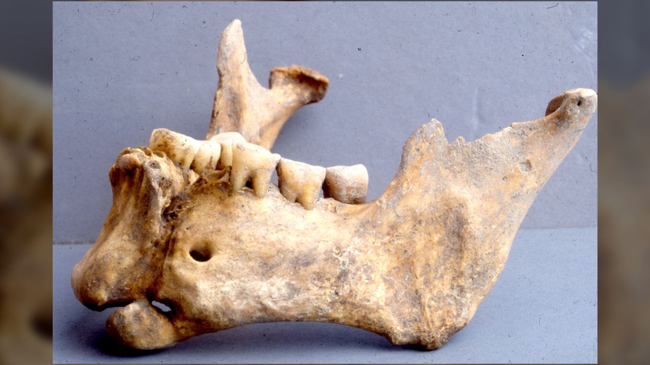 Notice the healed fracture at the front of the the warrior's lower jaw.