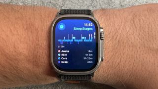An Apple Watch on a wrist showing sleep tracking