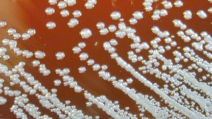 A culture of the bacteria Burkholderia pseudomallei, which causes melioidosis. The disease is rare in the U.S.