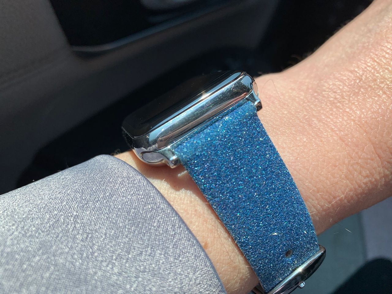 CASETiFY Apple Watch Band