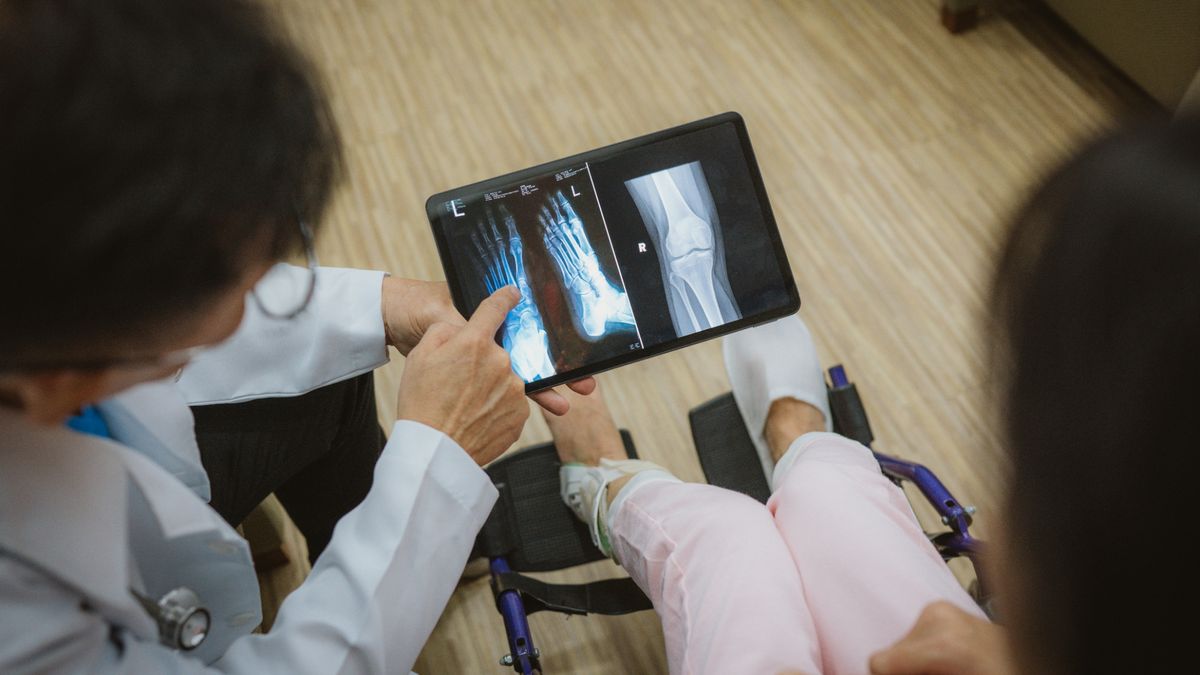 Researchers develop modified glue gun that can print bone — device 3D prints synthetic grafts directly onto patients’ living tissue during surgery