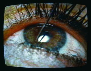 A close-up of Marina Abramovic's eye.