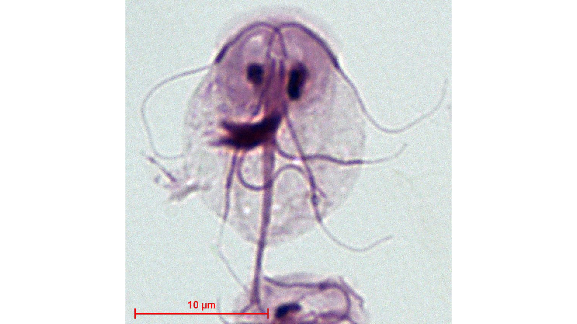 A microscopic image of giardia intestinalis. The nucleus, flagella, parabasal body, and axonemes are visible.