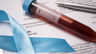 Getting prostate cancer treatment promptly is key, blue campaign ribbon and testing kit