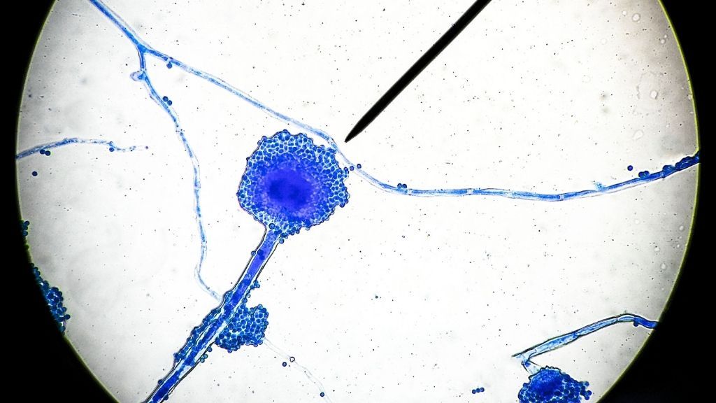 Microscopic image of a filamentous fungus that causes mucormycosis, a relatively rare fungal infection