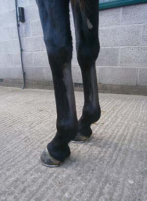 A tendon injury which has been treated with stem cells