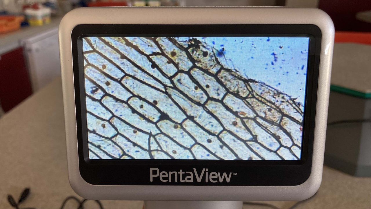 onion epidermis on a microscope screen