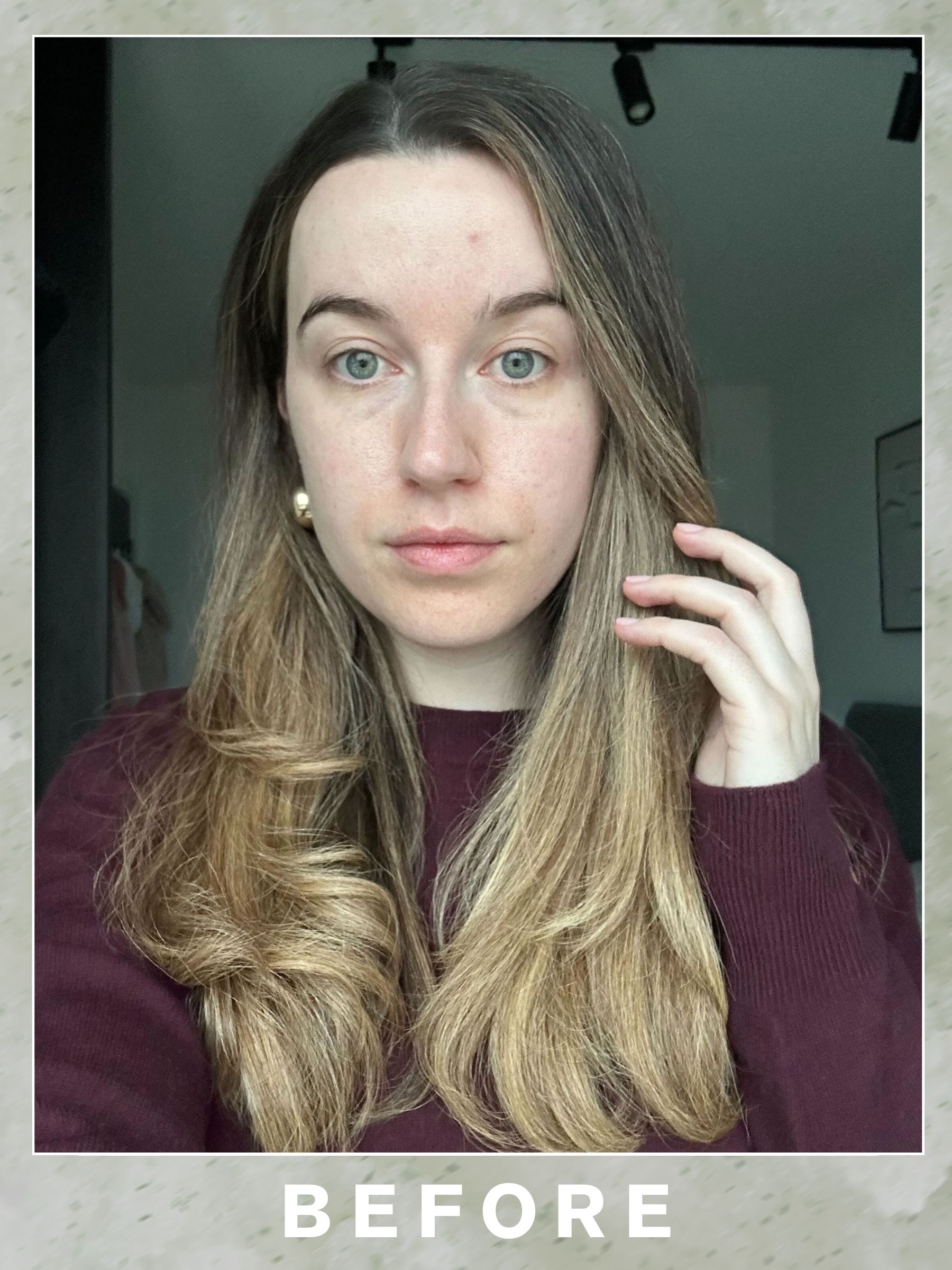 Junior beauty editor Grace Lindsay before having a Hydrafacial