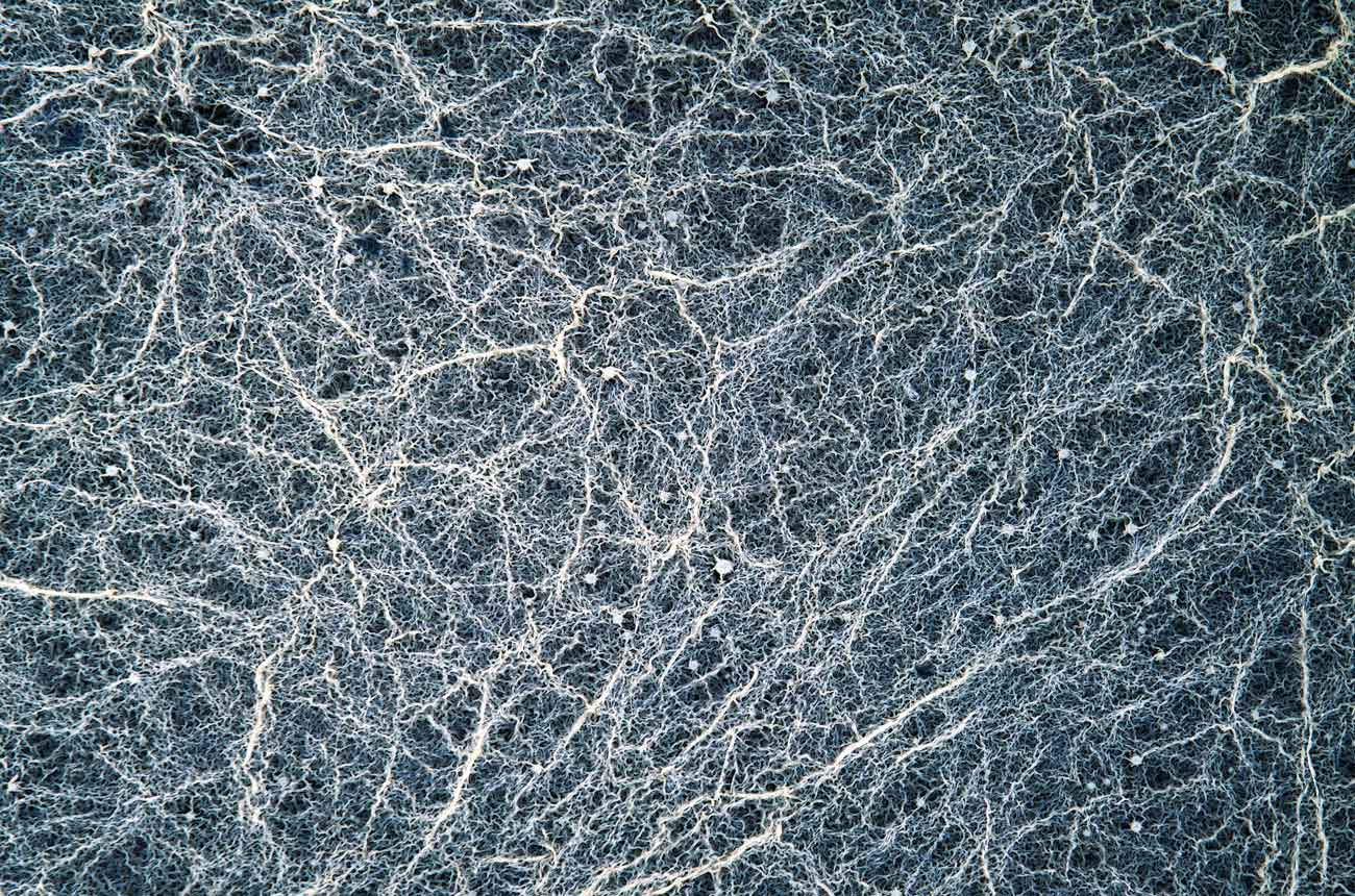 Brettanomyces yeast growing rapidly on sugars