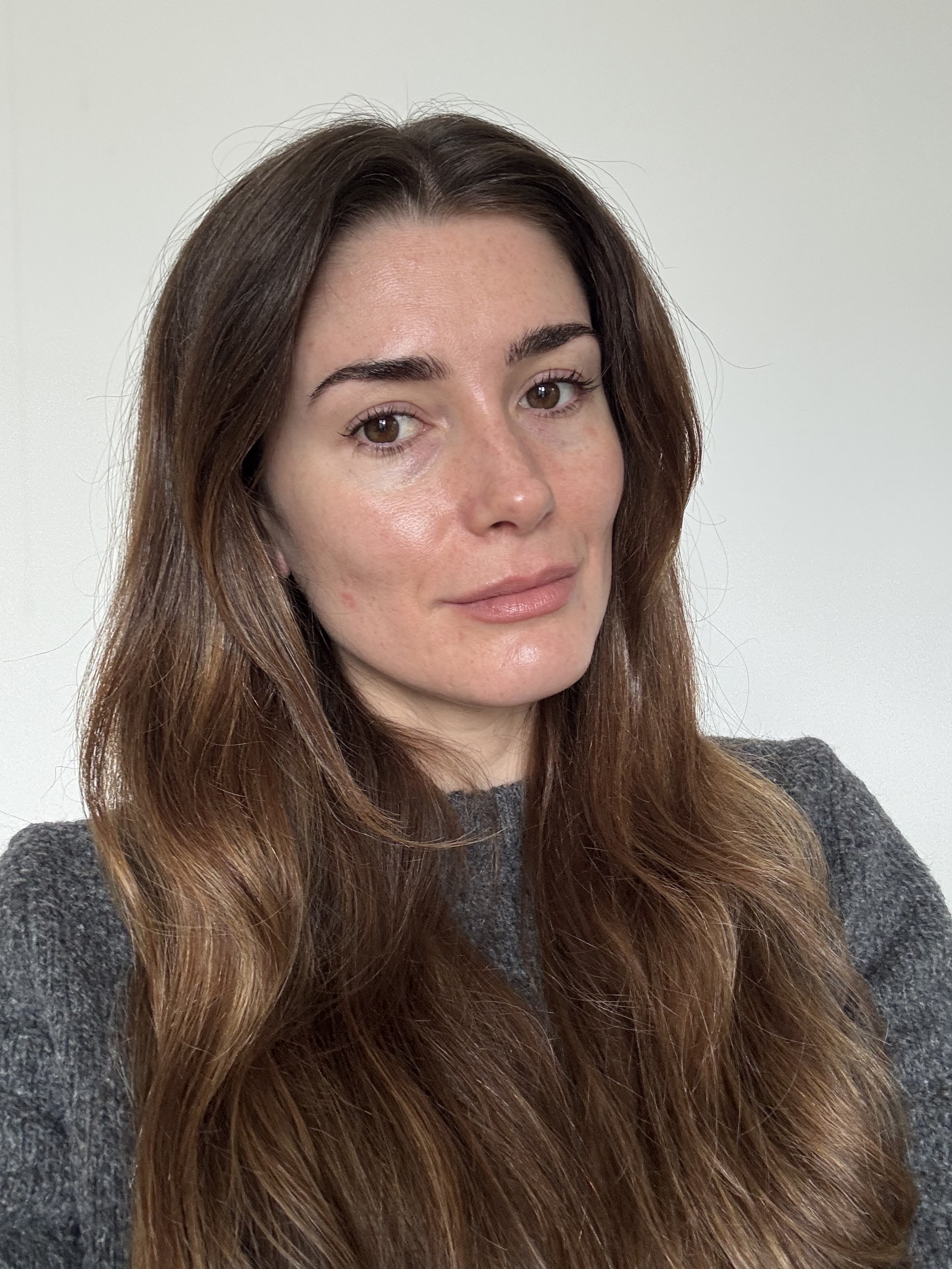 Eleanor's skin before testing Keskine LED mask