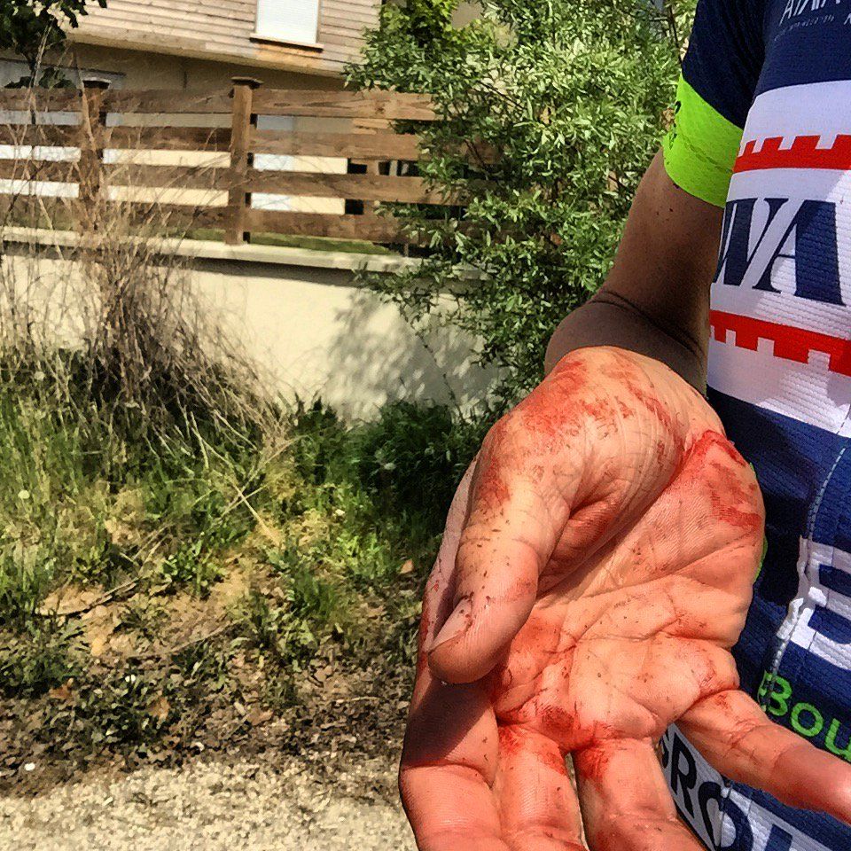 Yoann Offredo after being attacked while training
