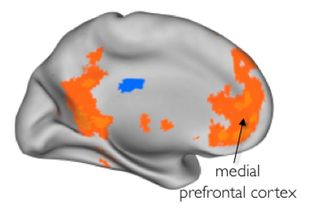 Brains Hard Wired To Connect With Friends Live Science