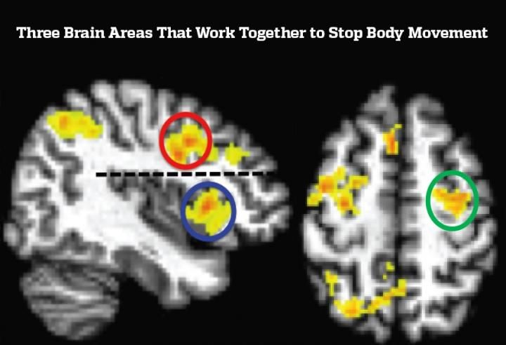 An image from the study shows three areas of the brain involved in arresting decisions.