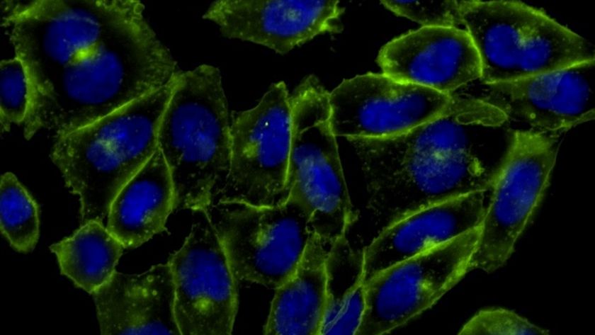 a microscope image of fluorescent cells