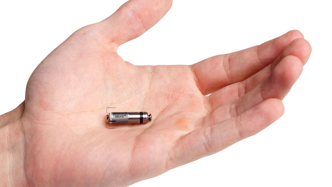 This pacemaker is small that you don&#039;t even need surgery