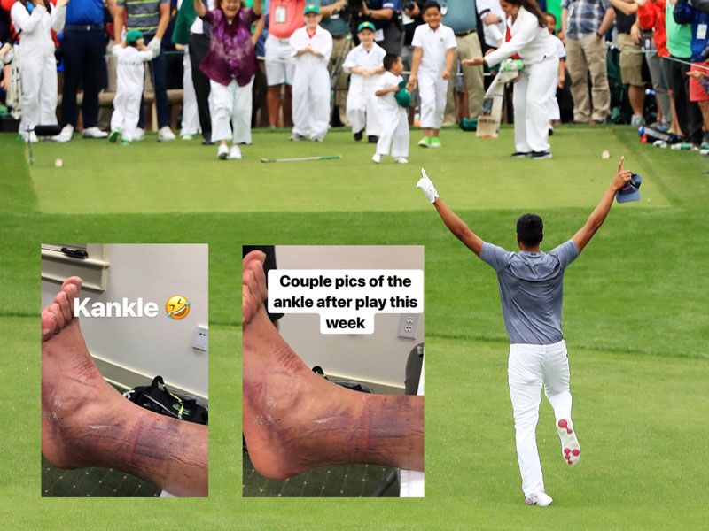 Tony Finau Dislocates Ankle