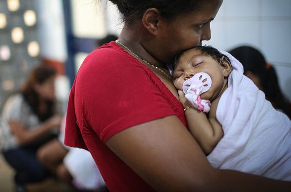 An infant with microcephaly.