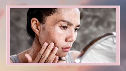 woman looking at dark spots in mirror