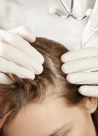 Scalp health