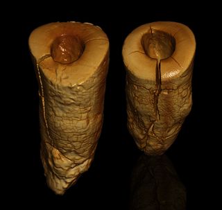 Researchers analyzed the horizontal striations inside the tooth holes, and concluded that these scratch marks were most likely produced by the scraping and twisting of a hand-held tool.