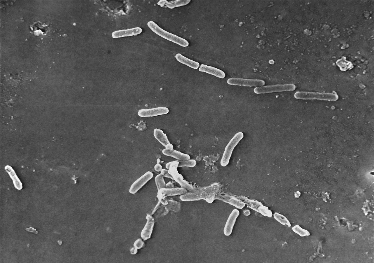 The bacteria Pseudomonas aeruginosa under a microscope.