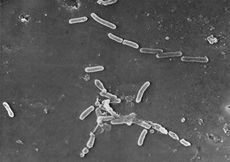 The bacteria Pseudomonas aeruginosa under a microscope.