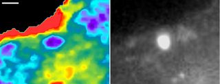 A newly designed fluorescent biosensor shows where Rac1, a molecule involved in cancer metastasis, is active in this cell. Warmer colors show greater Rac1 activity. 