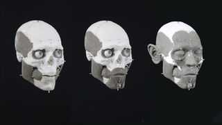 Nilsson used forensic methods to recreate the man's muscles and other facial features.