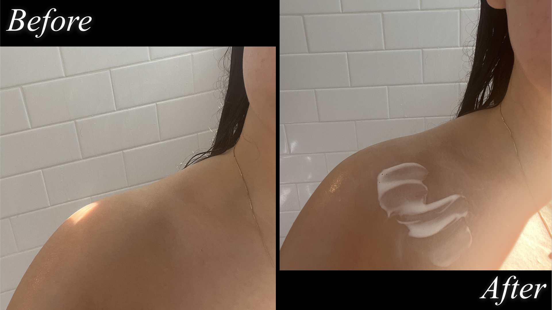 before and after testing panoxyl acne foaming wash