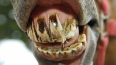 A horse&rsquo;s teeth