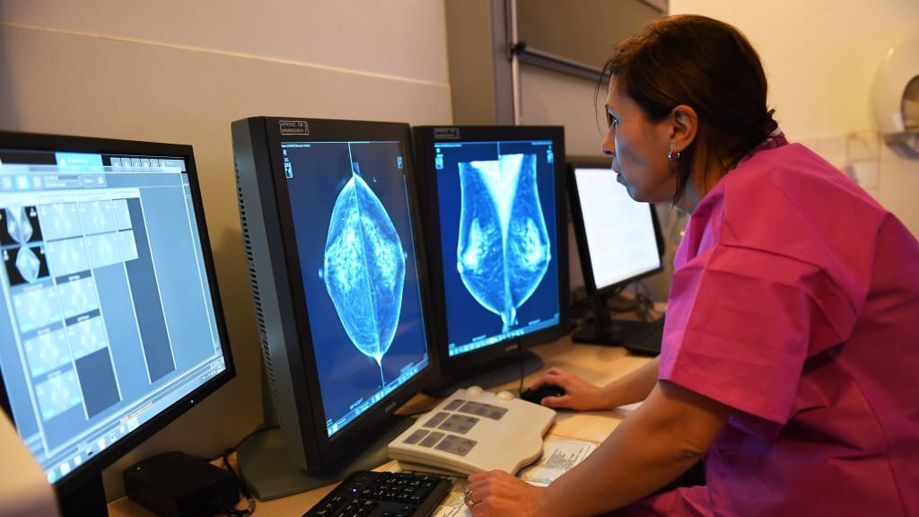 AI software shows promising results in detecting breast cancer