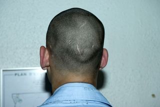 back of male models head with shaved hair
