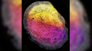 Image showing an example of one of the new, circular brain organoids with stem cells in gray around the edge and nerve cells color graded from yellow at the top to purple at the bottom in terms of their depth relative to the outside of the minibrain