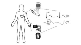 Samsung patent images showing PPG data converted into ECG data