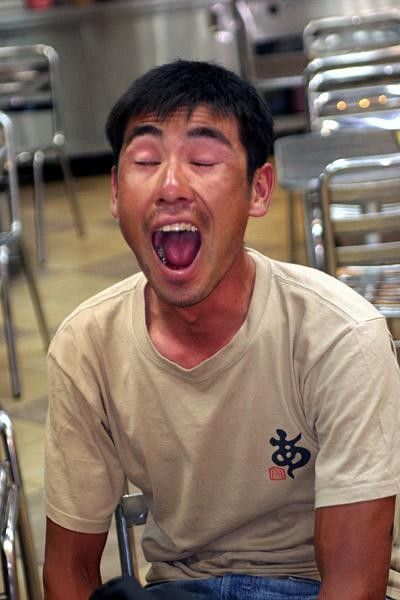 Koji Fukushima shows his dental work