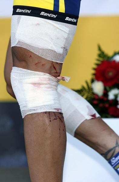 Johnny Hoogerland suffered deep lacerations to his legs after crashing onto a barbed wire fence near the end of stage nine.