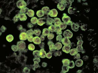 Naegleria fowleri brain eating amoeba