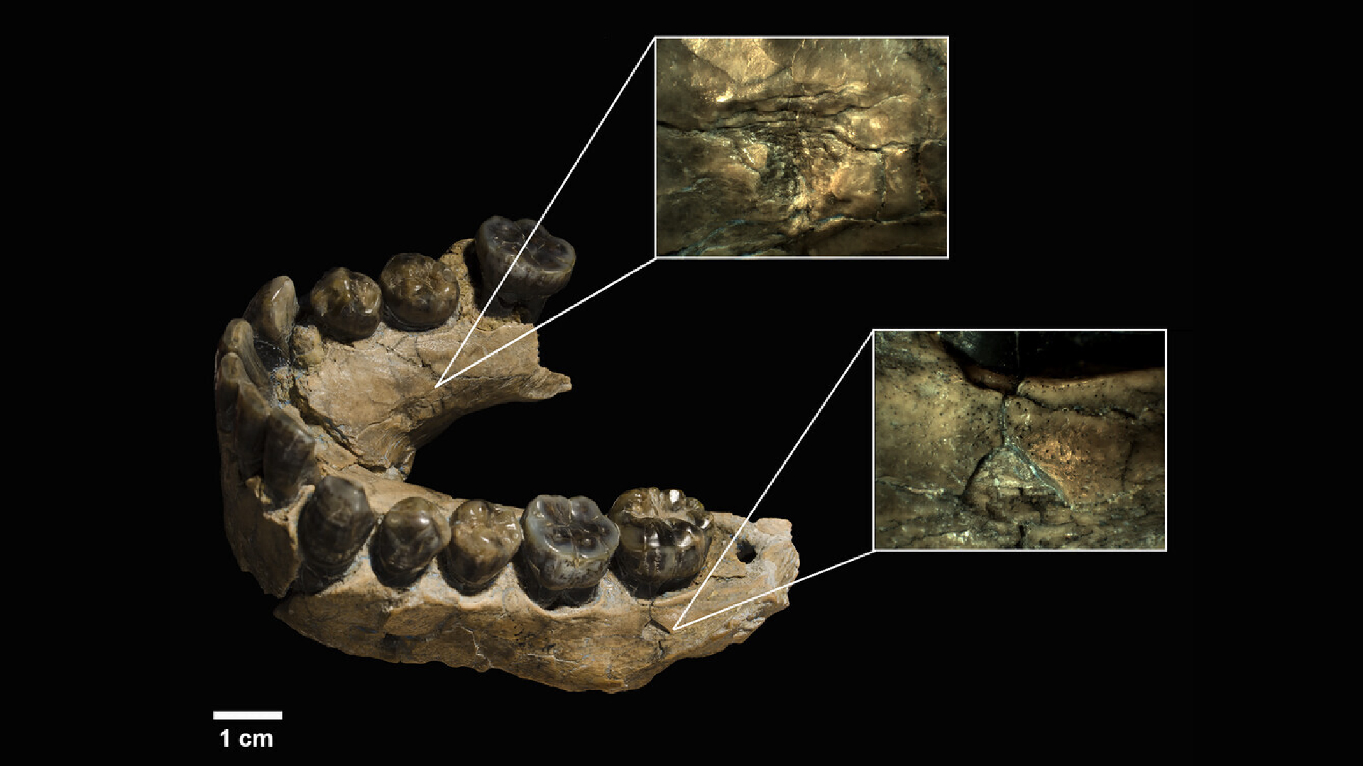 a close-up of details on a human jaw bone