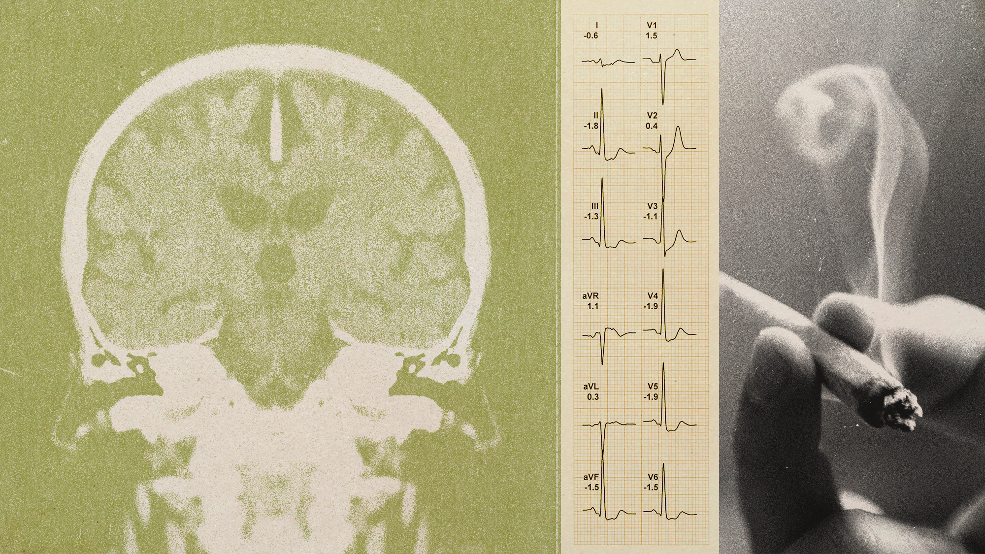 Photo collage of a brain scan, ECG printouts, and a hand holding a joint