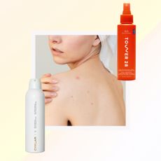 a woman with body acne on her back in a towel with two body acne skincare products next to her