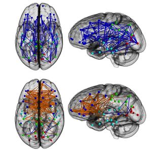 male and female brains