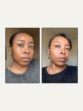 Remi before and after testing Currentbody LED mask